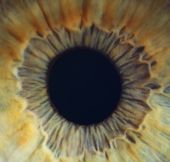 diagnosi glaucoma napoli