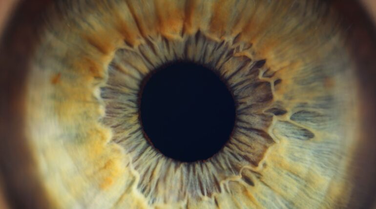 diagnosi glaucoma napoli